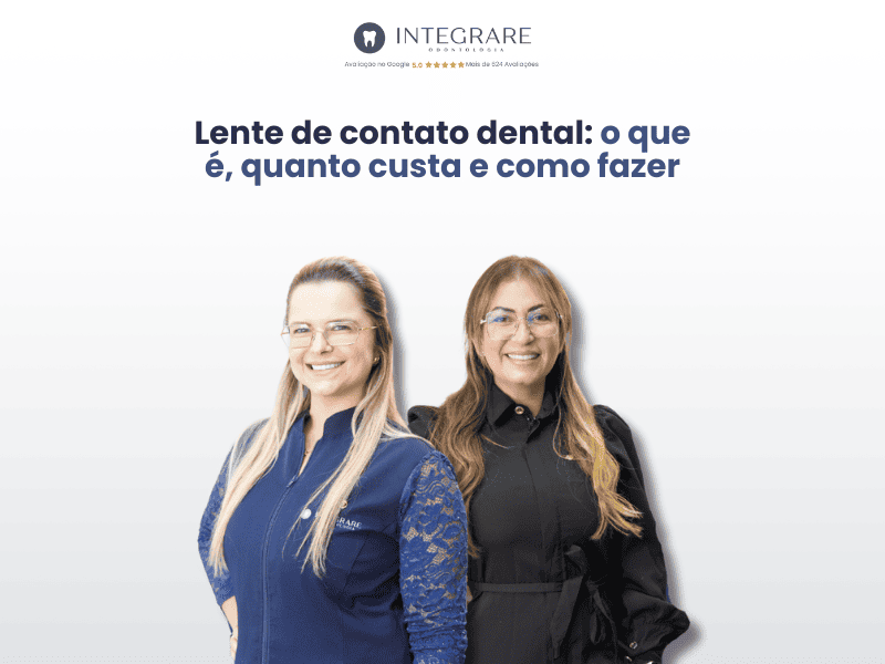 Lente de contato dental: o que é, quanto custa e como fazer