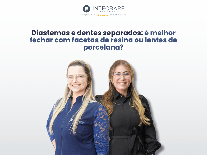 Diastemas e dentes separados: é melhor fechar com facetas de resina ou lentes de porcelana?