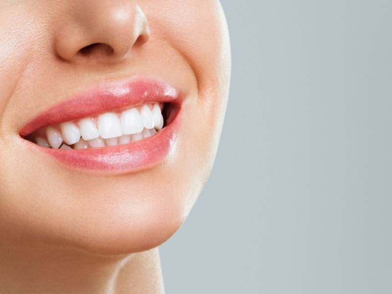 Clareamento Dental