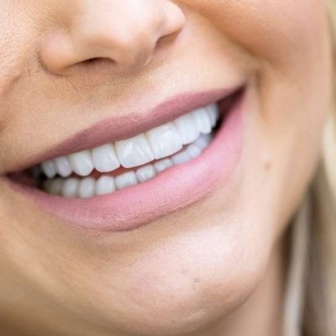 Odontologia Estética em Porto Alegre