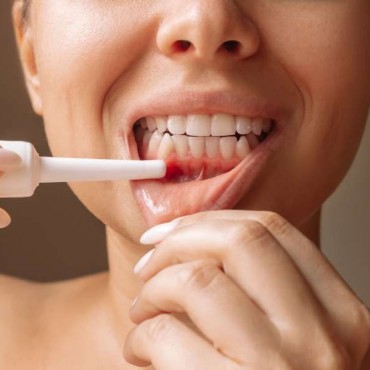 Periodontia em Porto Alegre