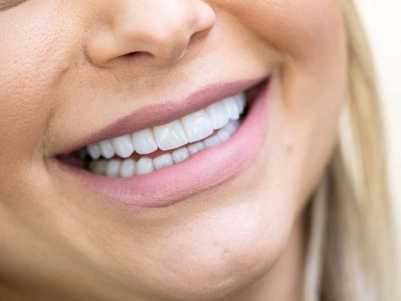 Odontologia Estética