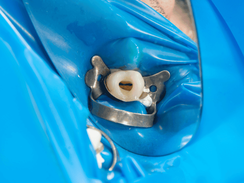 Endodontia
