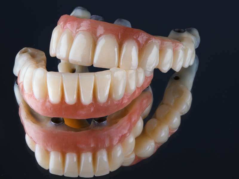 Prótese Dentária