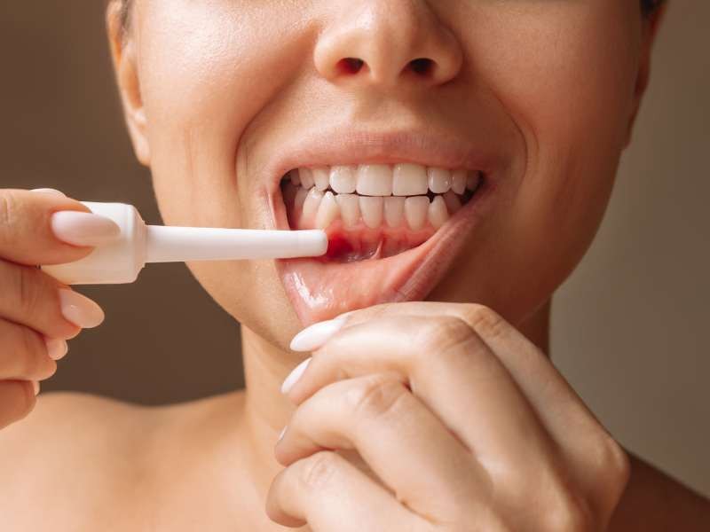 Periodontia