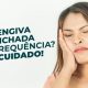 gengiva fica inchada