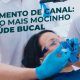 Tratamento de canal O vilão mais mocinho da saúde bucal blog